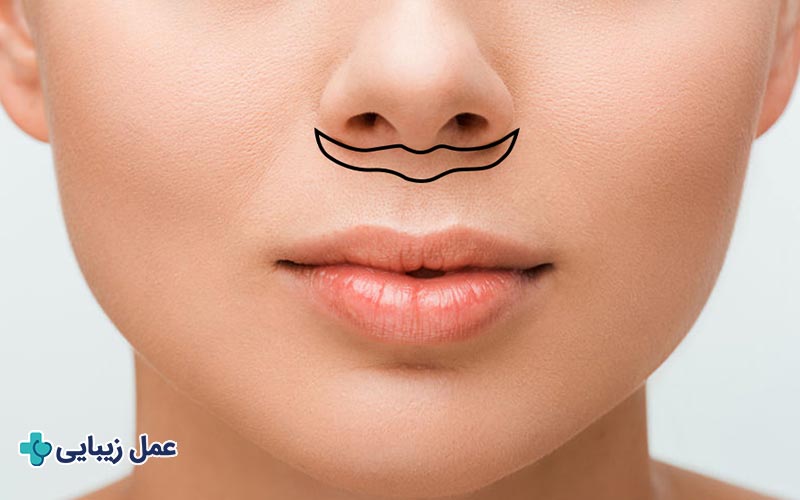 سانترال لب 2 سانترال لب چیست؟