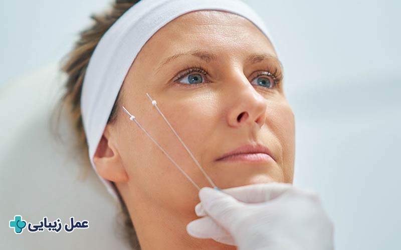 قبل و بعد از جراحی بوکال فت