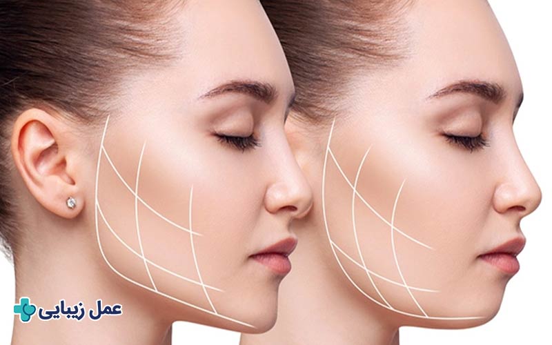 انواع بوکال فت