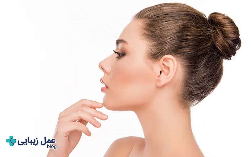 لیفت غبغب؛ مزایا، معایب و قیمت در سال 1404 3 انواع روش لیفت غبغب