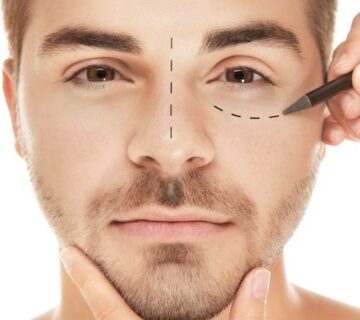 بلفاروپلاستی برای آقایان