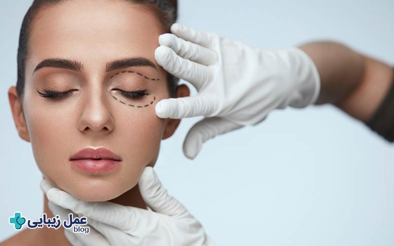 عمل زیبایی چشم چیست و چه تاثیری دارد؟ 3 فرق عمل زیبایی چشم و عمل درمانی چشم