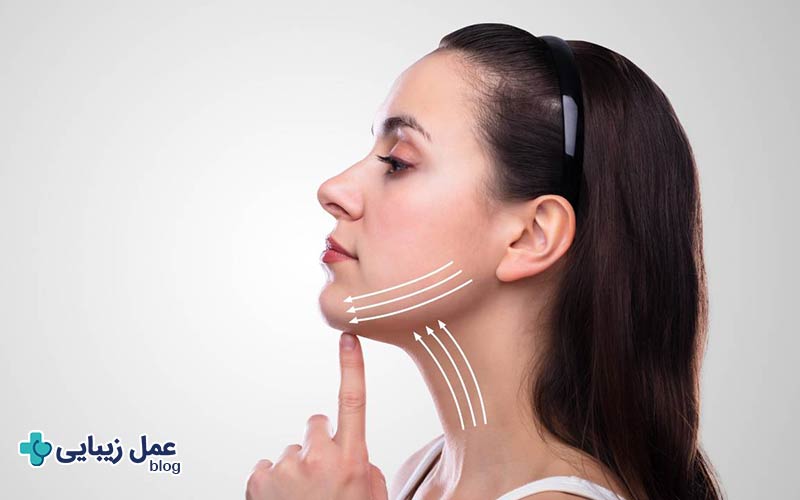 بهترین روش زاویه سازی فک؛ انواع، کاربردها و قیمت 6 ماندگاری زاویه سازی فک چقدر است؟