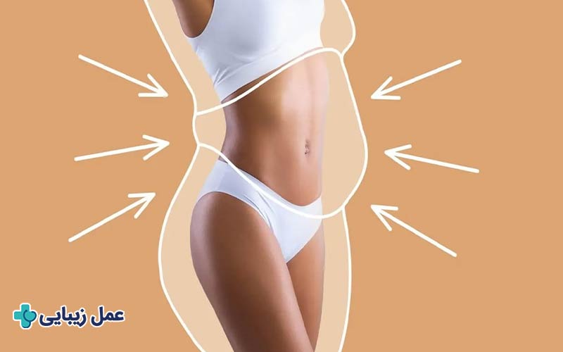 پیکر‌تراشی چیست و چه کاربردی دارد؟