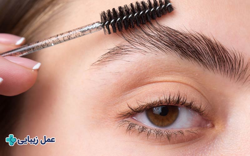 کاشت ابرو چگونه انجام می‌شود؟