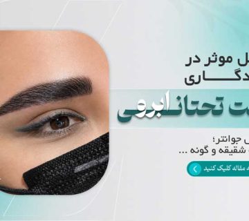عوامل موثر در ماندگاری لیفت تحتانی ابرو