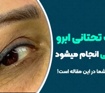 آیا لیفت تحتانی ابرو با بیهوشی انجام می‌شود؟