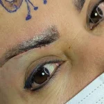 آیا لیفت تحتانی ابرو باعث ریزش ابرو می‌شود؟