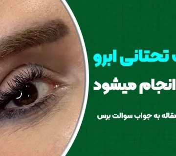 آیا لیفت تحتانی ابرو سرپایی انجام می‌شود؟