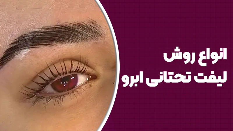 انواع روش لیفت تحتانی ابرو