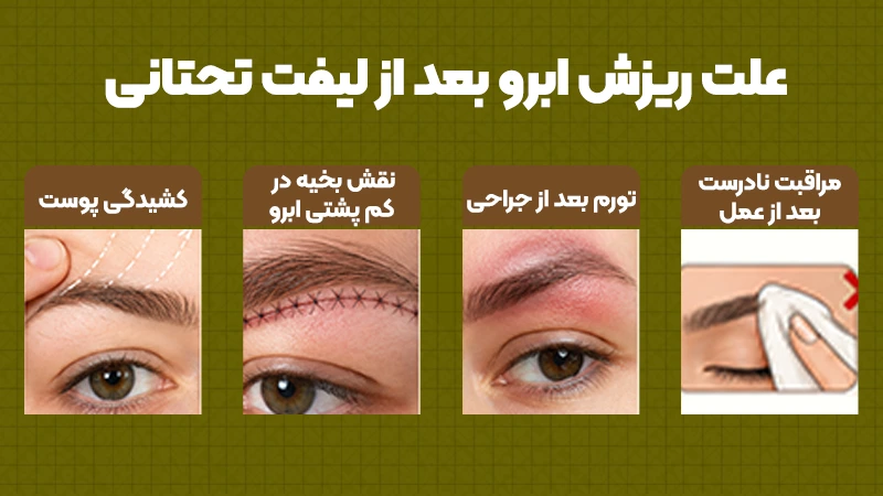 علت ریزش ابرو بعد از لیفت تحتانی ابرو