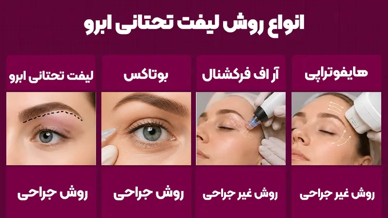 انواع روش‌های لیفت تحتانی ابرو