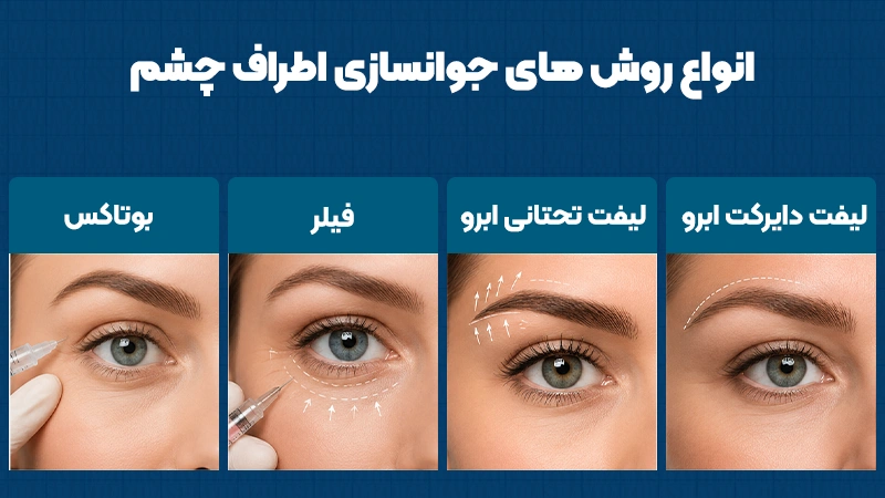 جوانسازی اطراف چشم 2 انواع روشهای جوانسازی اطراف چشم