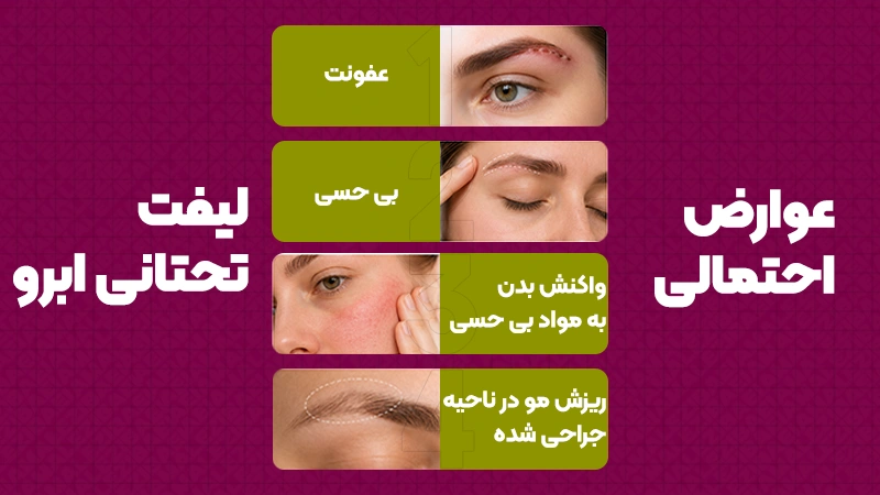 عوارض لیفت تحتانی ابرو
