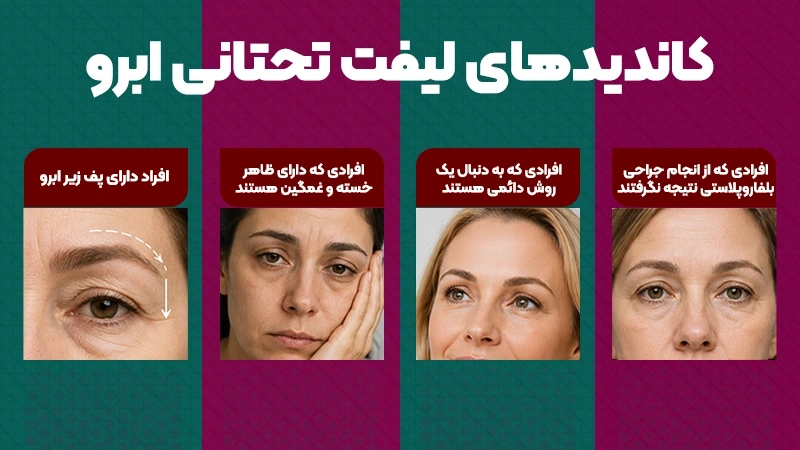 لیفت تحتانی ابرو برای چه کسانی مناسب است؟ 2 بهترین سن برای انجام لیفت تحتانی