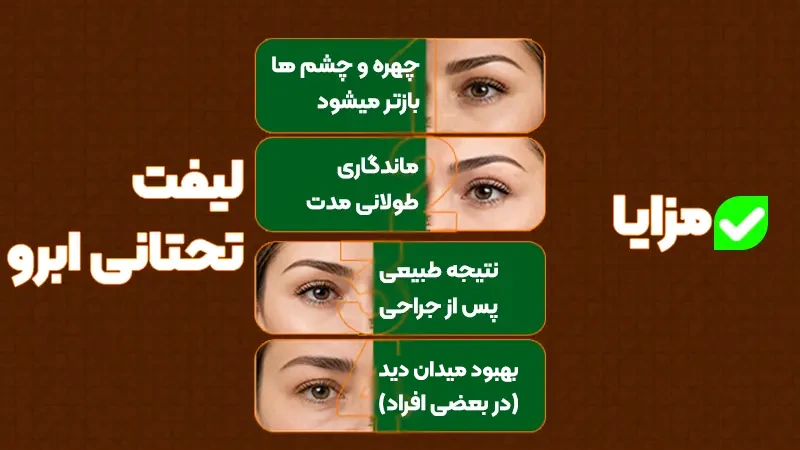 مزایای لیفت تحتانی ابرو 2 مزایای لیفت تحتانی ابرو در خانمها