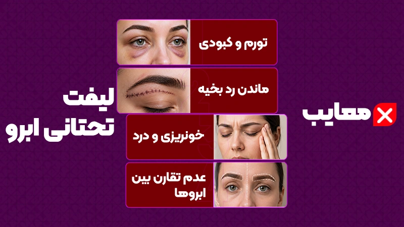 معایب لیفت تحتانی ابرو در خانم‌ها