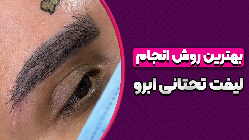 بهترین روش انجام لیفت تحتانی ابرو