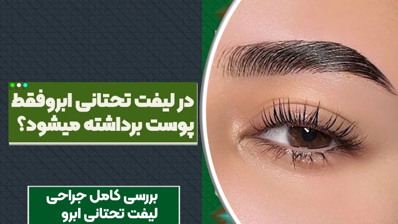 در لیفت تحتانی ابرو فقط پوست برداشته می‌شود؟