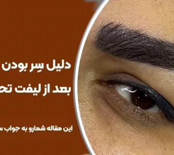 سر بودن چشم‌ها بعد از لیفت تحتانی ابرو