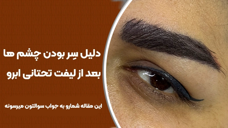 سر بودن چشم‌ها بعد از لیفت تحتانی ابرو