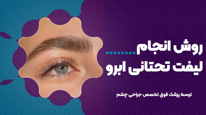 روش انجام لیفت تحتانی ابرو 1 روش انجام لیفت تحتانی ابرو