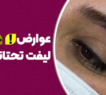 عوارض لیفت تحتانی ابرو
