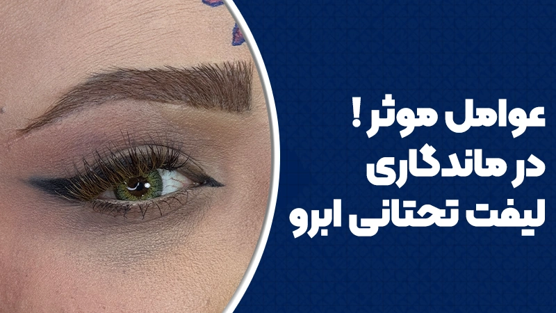 عوامل موثر در ماندگاری لیفت تحتانی ابرو