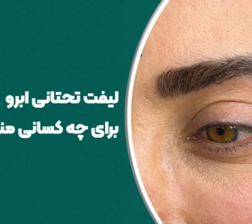 لیفت تحتانی ابرو برای چه کسانی مناسب است؟