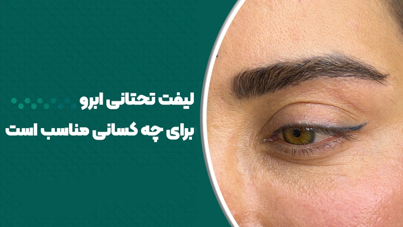 لیفت تحتانی ابرو برای چه کسانی مناسب است؟ 1 لیفت تحتانی ابرو برای چه کسانی مناسب است؟