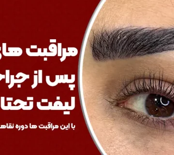 مراقبت‌های پس از جراحی لیفت تحتانی ابرو