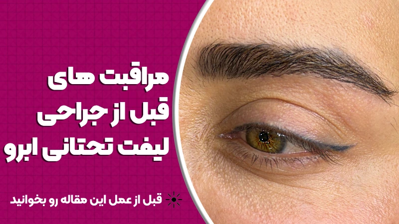 مراقبت‌های قبل از جراحی لیفت تحتانی ابرو