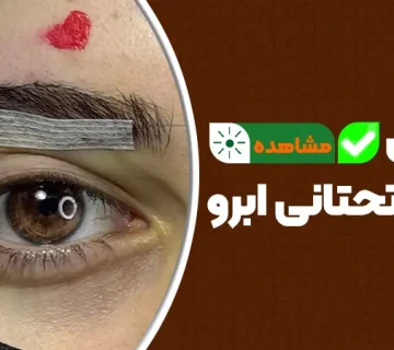 مزایای لیفت تحتانی ابرو