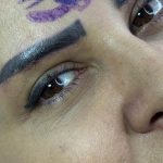 مزایای لیفت تحتانی ابرو