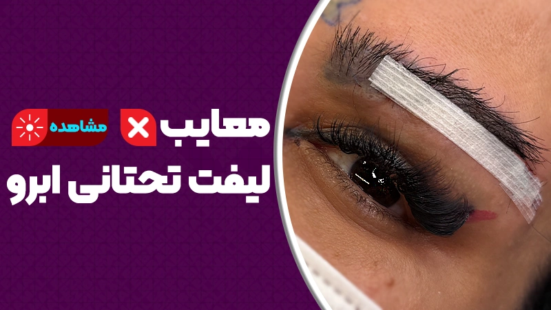 معایب لیفت تحتانی ابرو