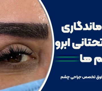 میزان ماندگاری لیفت تحتانی ابرو در خانم‌ها