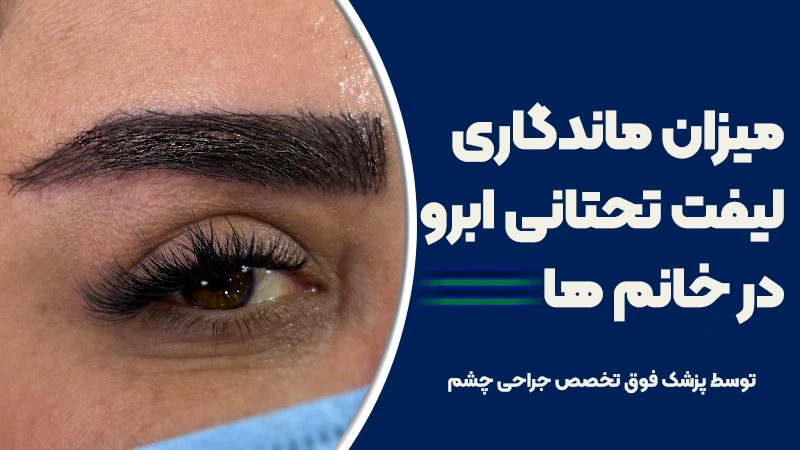 میزان ماندگاری لیفت تحتانی ابرو در خانم‌ها