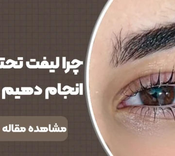 چرا لیفت تحتانی ابرو انجام دهیم؟