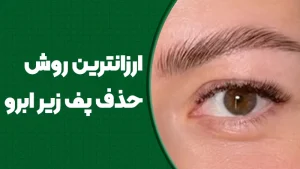 ارزان‌ترین روش حذف پف زیر ابرو
