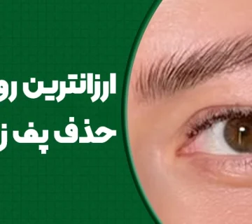 ارزان‌ترین روش حذف پف زیر ابرو