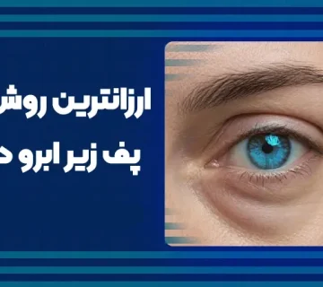 ارزان‌ترین روش حذف پف زیر ابرو در خانه