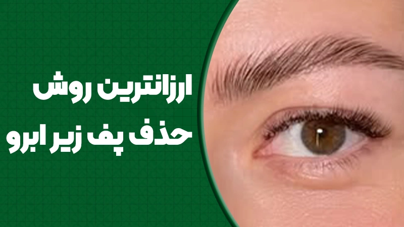 ارزان‌ترین روش حذف پف زیر ابرو