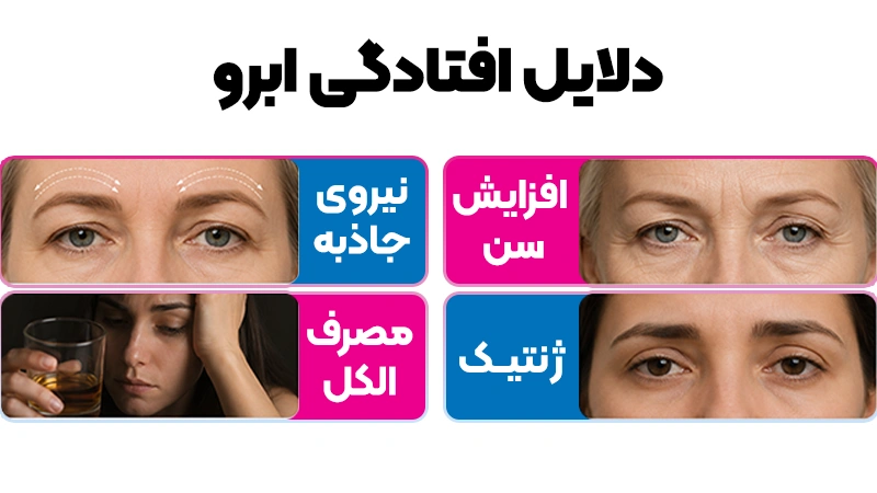 دلایل افتادگی ابرو