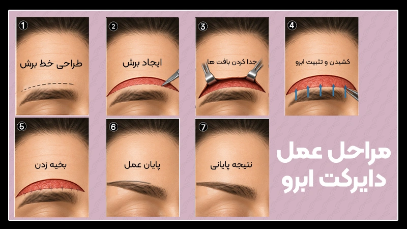 دایرکت ابرو مناسب چه کسانی میباشد؟ 3 ماندگاری دایرکت ابرو