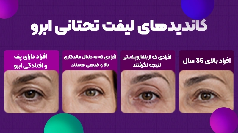 کاندیدهای مناسب لیفت تحتانی ابرو