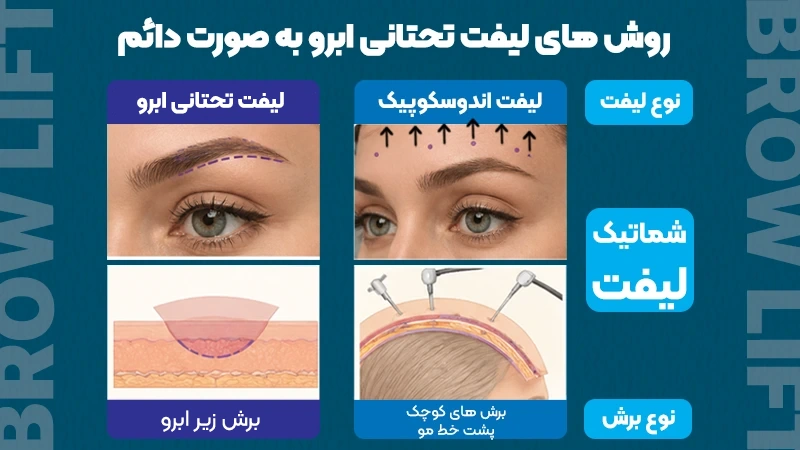 لیفت تحتانی ابرو به صورت دائم