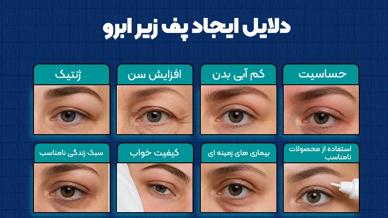 دلایل ایجاد پف زیر ابرو