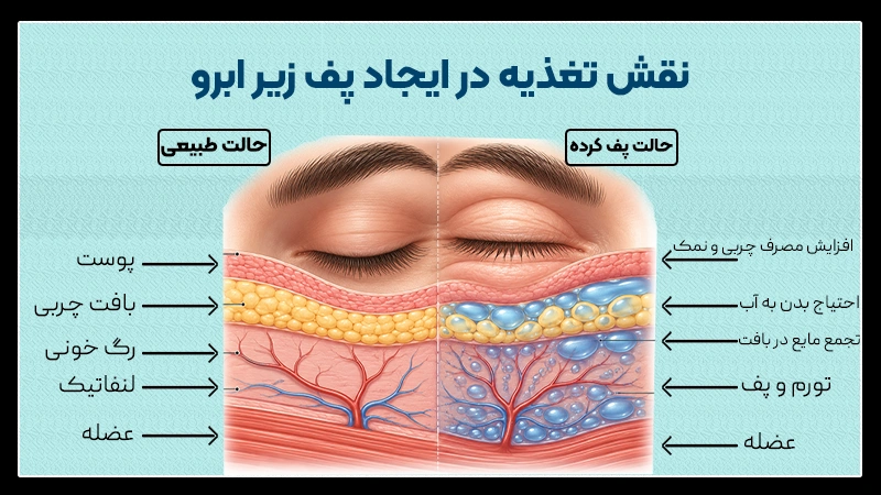 نقش تغذیه در ایجاد پف زیر ابرو 3 تغذیه مناسب و تاثیر آن در پف زیر ابرو