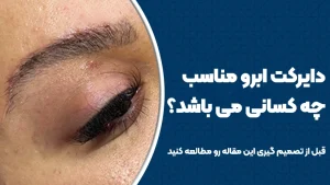 دایرکت ابرو مناسب چه کسانی می‌باشد؟