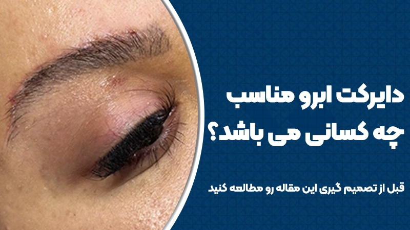 دایرکت ابرو مناسب چه کسانی میباشد؟ 1 دایرکت ابرو مناسب چه کسانی میباشد؟